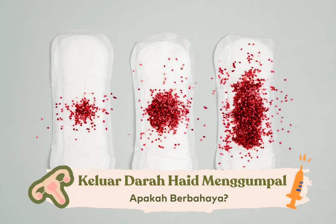 Pendarahan Tidak Normal: Penyebab, Gejala, Penanganannya